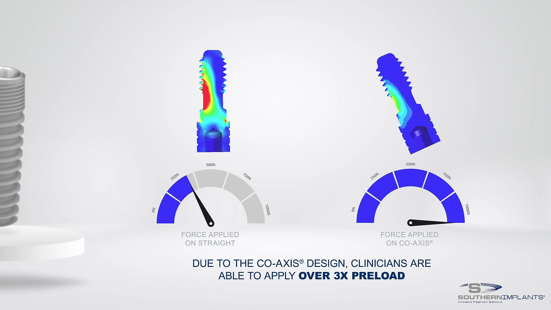 CoAxis Benefits of Features Part 2 (screw retained restorations)